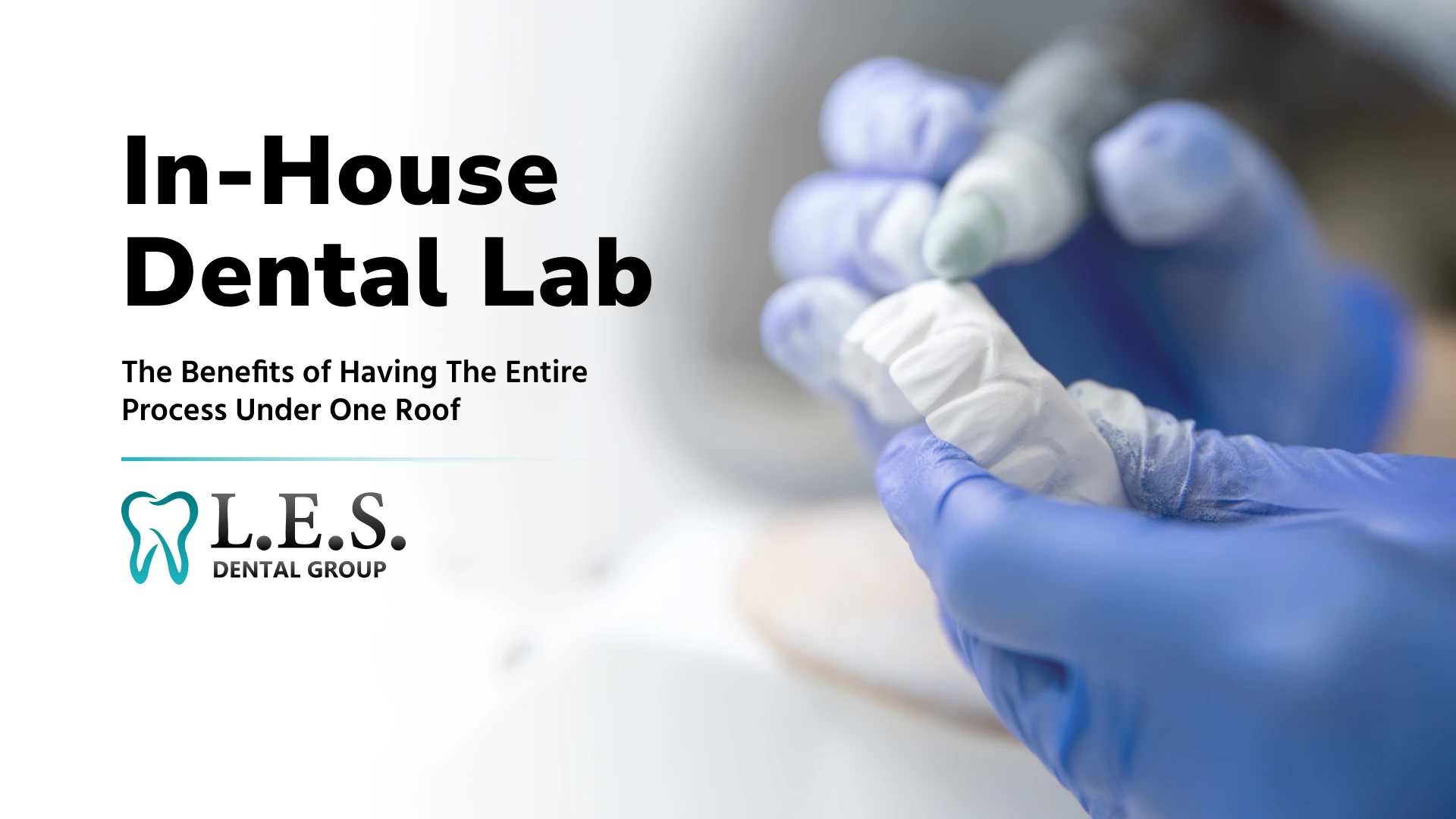 Benefits of an in-house dental lab